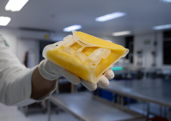 Fresh frozen plasma obtained through fractionation of whole blood donated altruistically on World Blood Donor Day.