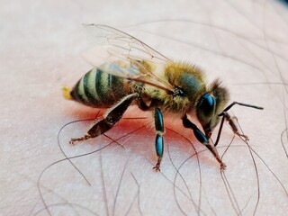 Bee sting in human skin
