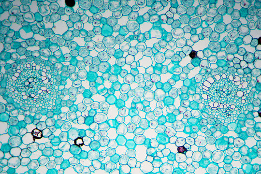 grassleaf sweelflag rhizome (Acorus gramineus) plant cells micrograph