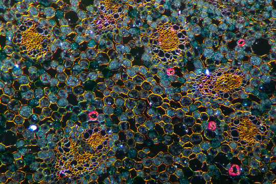 grassleaf sweelflag rhizome (Acorus gramineus) plant cells micrograph