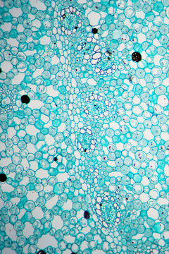 grassleaf sweelflag rhizome (Acorus gramineus) plant cells micrograph