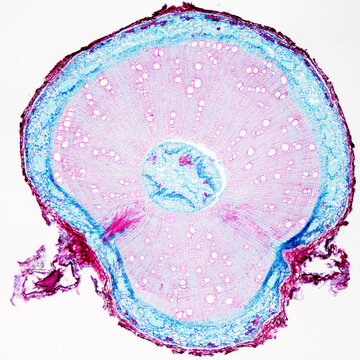 Chinese starjasmine stem plant cells micrograph