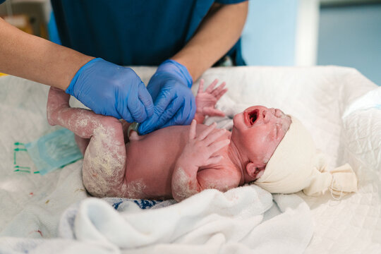 Doctor taking care of umbilical cord of newborn