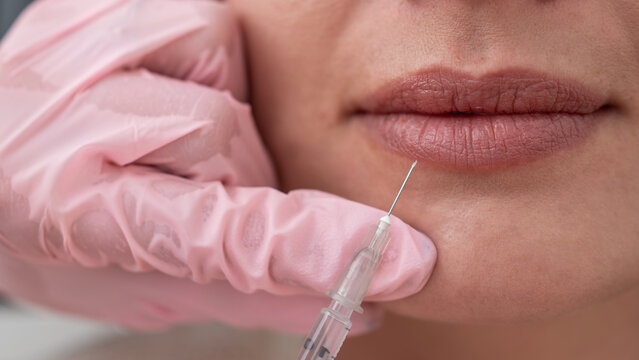 Close up of Beautiful woman Mouth and Lips: Female Doctor Injecting Botox for Lip Rejuvenation Skincare Treatment