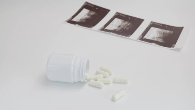 Abortion pills, contraceptive medicine, female care, options for reproductive health