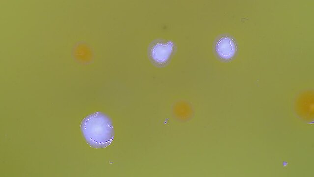 timelapse bacteria grow in petri dish