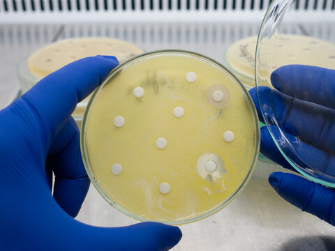 Round disks with antibiotics are placed in a Petri dish where Escherichia coli grows. Testing the effect of an antibiotic on bacteria.