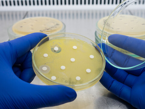 Antibiotic test for the growth of Escherichia coli on a nutrient medium in a Petri dish.