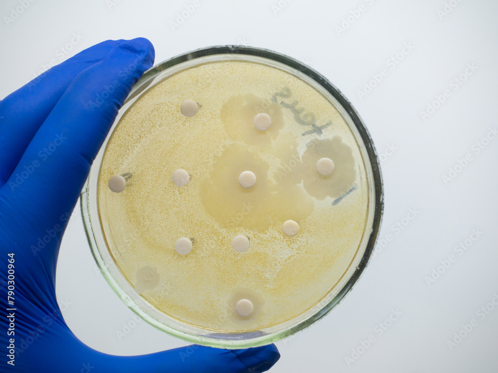 Wall mural Antibiotic on round discs does not affect the growth of bacteria on a petri dish.