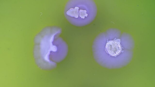 time lapse of bacteria growing