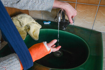 woman with a broken right arm in a cast washes her fingers free of a bandage under running water in the sink