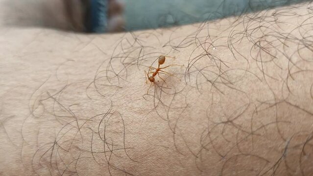 Red ants biting a man's leg