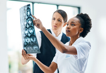 Hospital, teamwork and women doctors with brain scan for review, diagnosis or consultation. Healthcare, neurology and medical MRI results with professional collaboration, advice and nurse at clinic