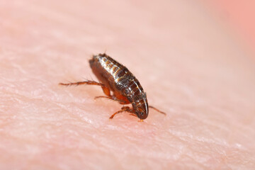 The flea feeds on human skin. Painful flea bite.
