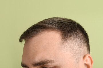 Obraz premium Young man with hair loss problem on green background, closeup