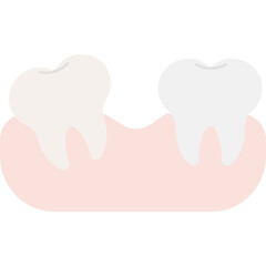 Dental Bridge Illustration