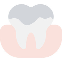 Fluoride Illustration