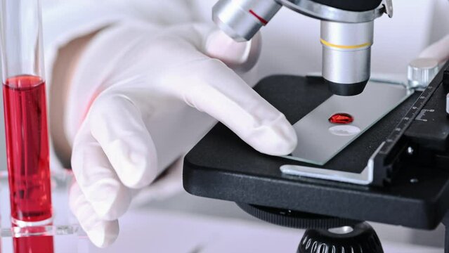 Scientist researching blood sample under microscope in laboratory. Doctor putting glass slide with blood sample under microscope.