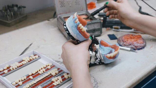 The hands of an orthodontic dental technician make a denture by working with molten liquid wax. Close-up