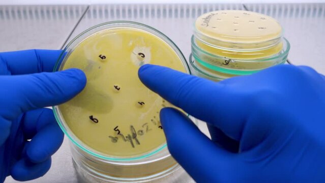 The scientist shows the white zone around the white disk with the antibiotic, the antibiotic affects the growth of bacteria.