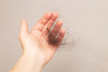close up photo of female hand holding lost hair in hand on a beige background.