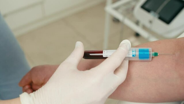 A close-up of the manipulation of blood sampling in the medical office. Diagnosis of the state of health using the latest technologies. High quality 4k footage