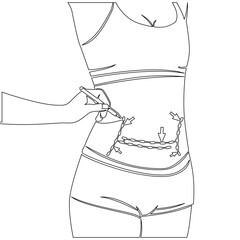 Continuous one single line drawing Surgical lines on slim body with marks on skin which show places for plastic surgery operation icon vector illustration concept