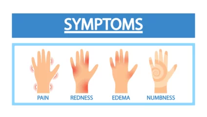 Foto op Plexiglas Arthritis Symptoms. Sick Hands With Joint Pain, Redness, Edema Or Numbness. Medical Infographic Poster © Pavlo Syvak