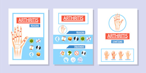 Vector Medical Posters with Arthritis Symptoms, Reasons and Treatment or Prevention Of The Disease, Risk Factors - 791821388