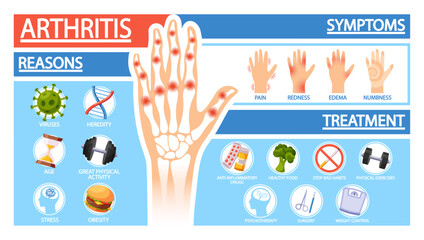 Arthritis Symptoms, Reasons and Treatment or Prevention Of The Disease, Risk Factors And Management Strategies - 791822702