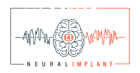 Implantation of a neural chip into the human brain.