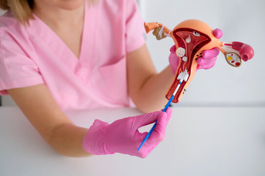 A close-up method of cytological examination by taking a smear from the cervix on an artificial training model. Diseases and cancers of the female reproductive organs