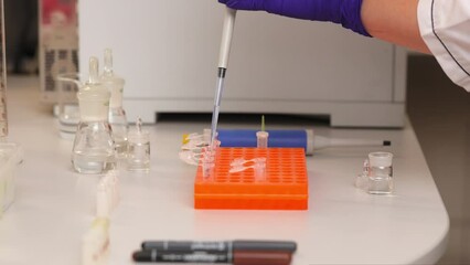 Hand of medical worker drawing liquid in automatic pipette and adding to test tubes fixed in special holder. Biochemical analysis provided in modern laboratory with high-quality instruments.