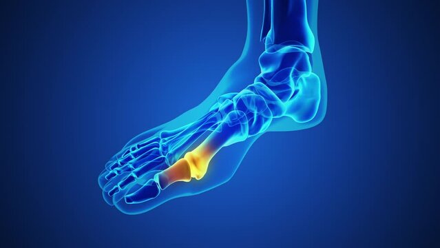 Painful gout inflammation on big toe joint