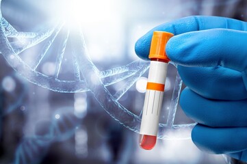 growth factor steam cell test tube in hand