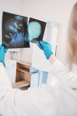 female doctor examines pictures of the skull in the x-ray room, in the background lies a patient with a traumatic brain injury and concussion