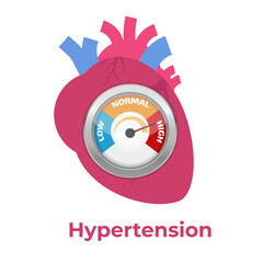 High blood pressure, hypertension concept. Vector illustration.