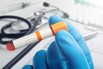 doctor holding test Blood tube for study