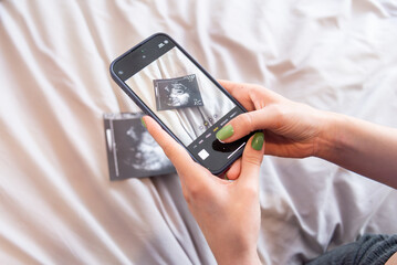 Expectant mother captures ultrasound photo on smartphone