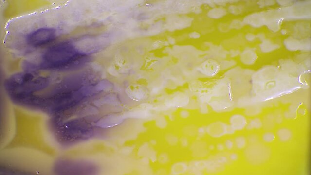 Time lapse of bacterial colony growth in infection analysis