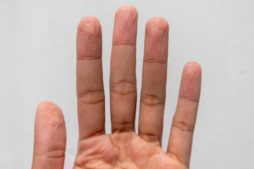 A man's wrinkled fingers because of soak in the water for a long time