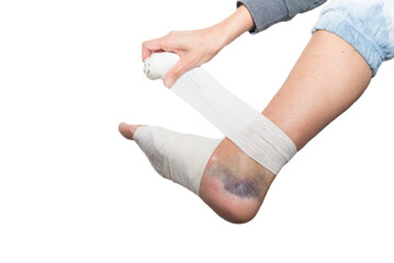 hand bandaging foot, sprain, strain, inflammation, fracture, medicine, close up