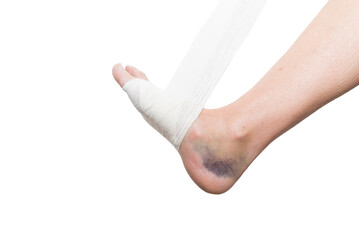 close up of bandaged foot, sprain, strain, inflammation