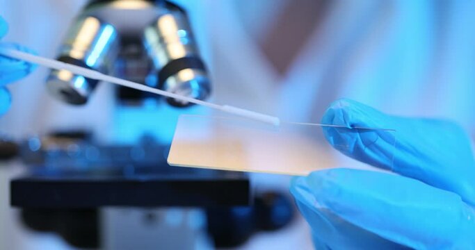 Biological tests have been carried out and a swab is examined for analysis.