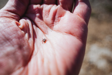 A tick infected with encephalitis crawls on a person's hand, a small parasite.
