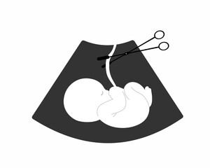 fetus baby with umbilical cord cut off with surgical forceps after miscarriage or abortion loss pregnancy vector illustration
