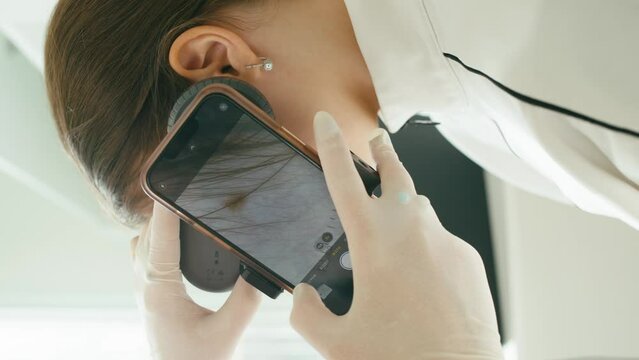 A close-up of the diagnosis of a birthmark on the skin of the face. An application is installed on the phone to attach a special magnifying glass. High quality 4k footage