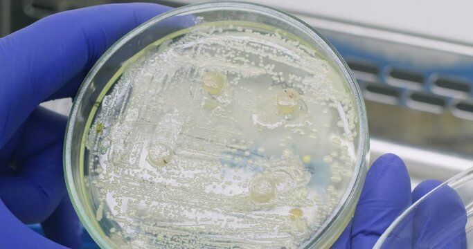 Laboratorian opens Petri dish with biomaterial sample in laboratory closeup. Lab worker checks development of organic culture in medical center