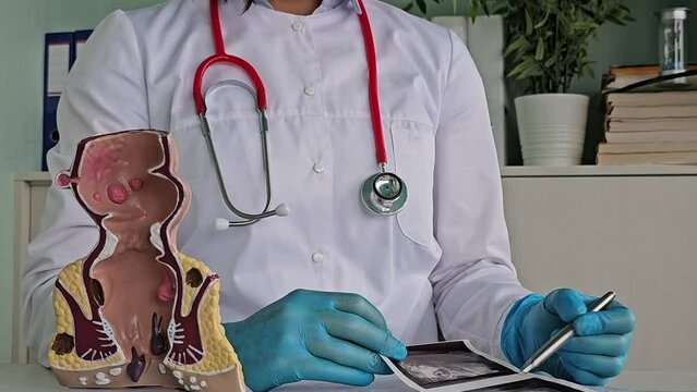 Rectum with a rectal probe. Ultrasound of the intestines and diseases, diagnostics and oncology