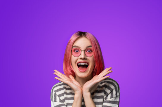 Excited surprised shock astonished very happy pink woman wear braces brackets sunglasses eye glass spectacles, open mouth, hold hands palms near face, isolated purple background. Mega sales ad concept